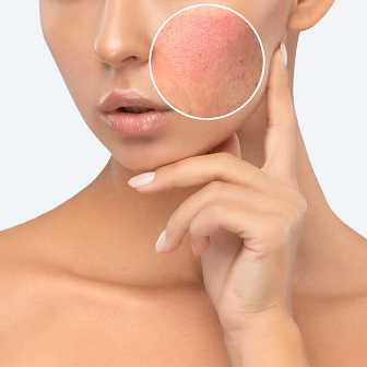 Как достичь ровного тонуса кожи без использования химических средств